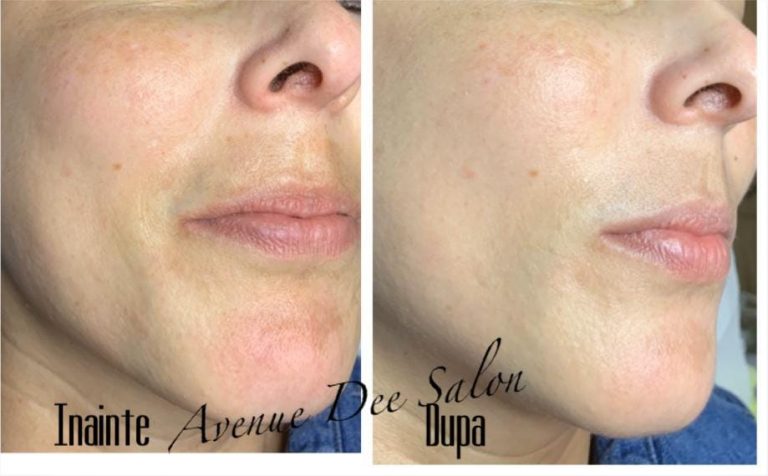 Tratament cosmetic BB GLOW la Salonul Avenue Dee din Târgoviște